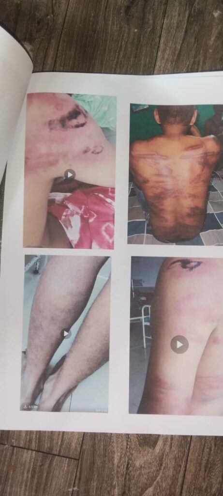 मारपीट के मामले को लेकर रायगढ़ पुलिस अधीक्षक से हुई शिकायत 2 IMG 20250514 WA0031